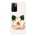 Xiaomi 11i / 11i Hypercharge phone case