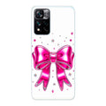 Xiaomi 11i / 11i Hypercharge phone case