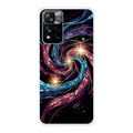 Xiaomi 11i / 11i Hypercharge phone case
