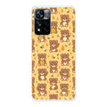 Xiaomi 11i / 11i Hypercharge phone case