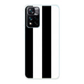 Xiaomi 11i / 11i Hypercharge phone case