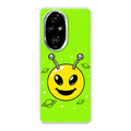Honor 200 Pro phone case