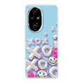 Honor 200 Pro phone case