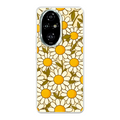 Honor 200 Pro phone case