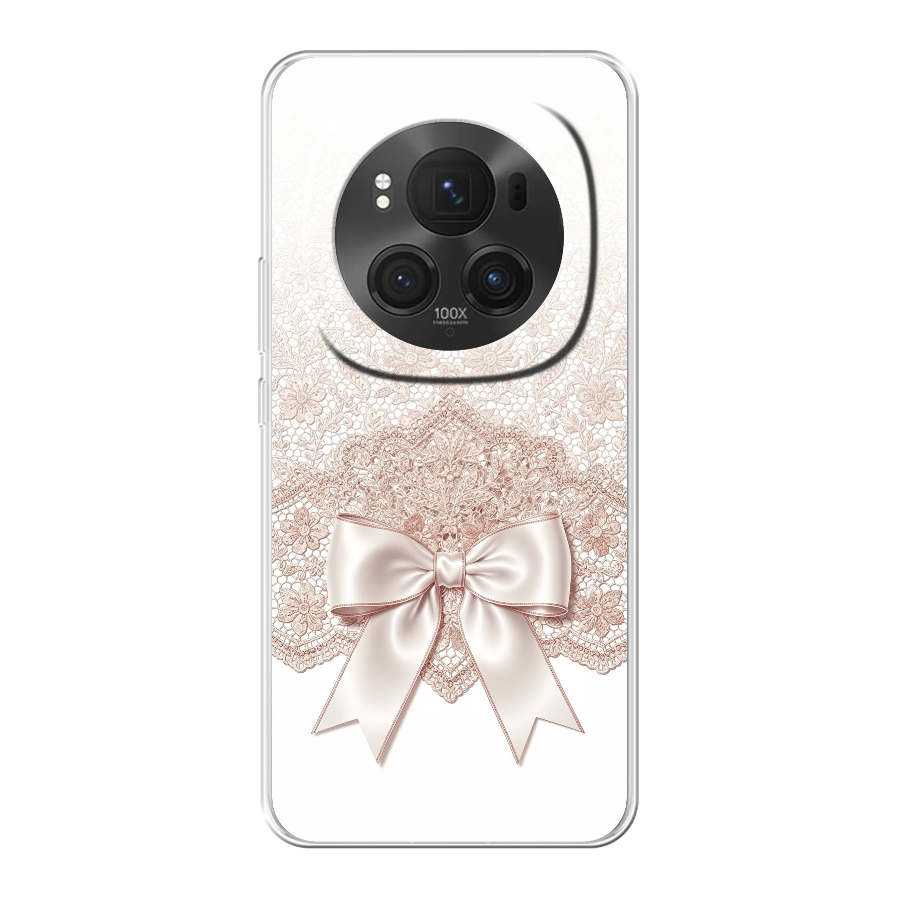 Honor Magic6 Pro phone case