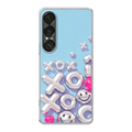 Sony Xperia 1 VII phone case