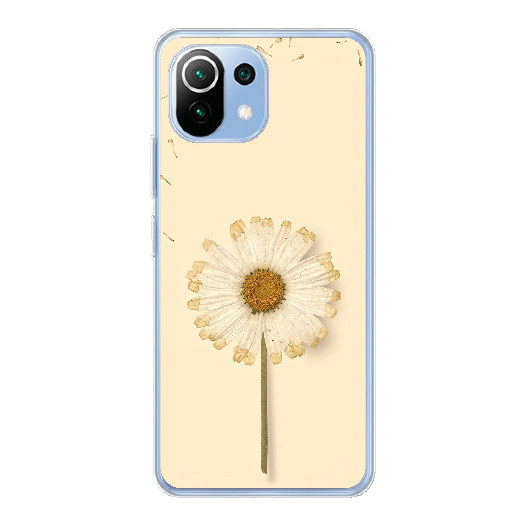 Xiaomi Mi 11 Lite / Xiaomi 11 Lite 5G NE phone case