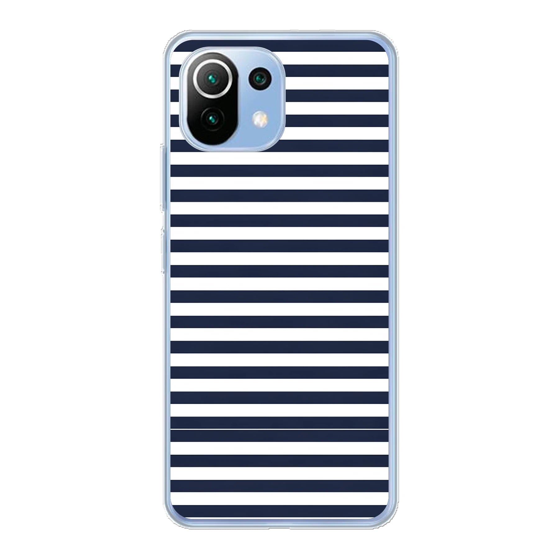 Xiaomi Mi 11 Lite / Xiaomi 11 Lite 5G NE phone case