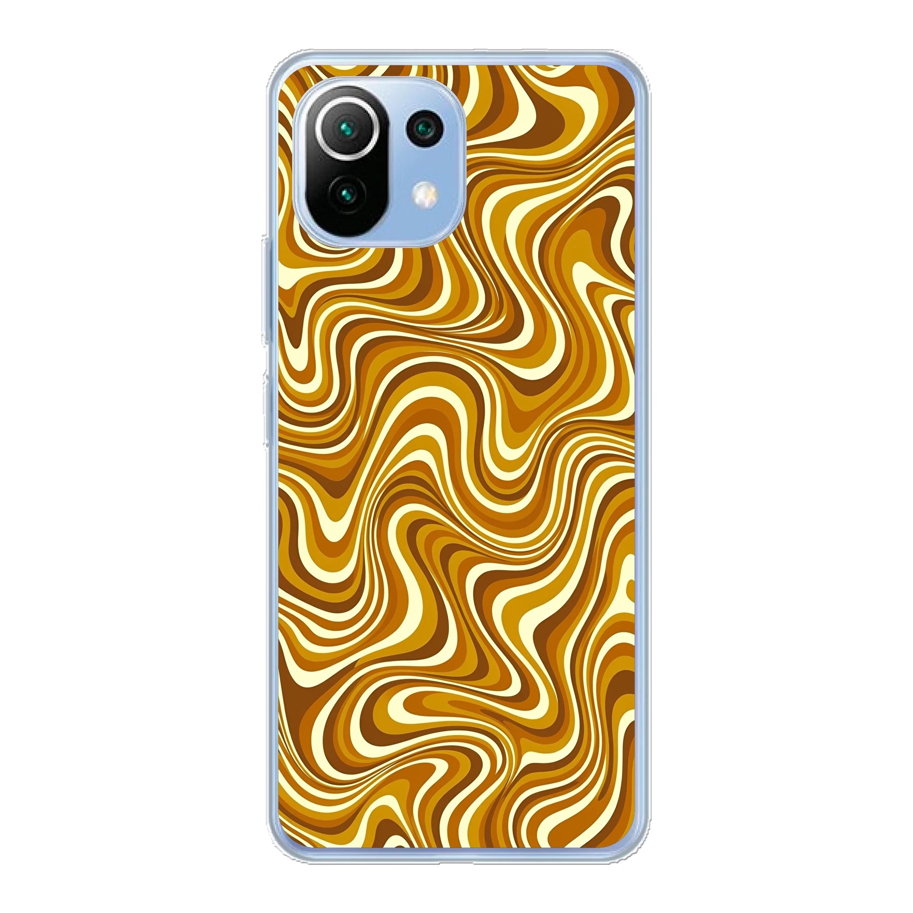 Xiaomi Mi 11 Lite / Xiaomi 11 Lite 5G NE phone case