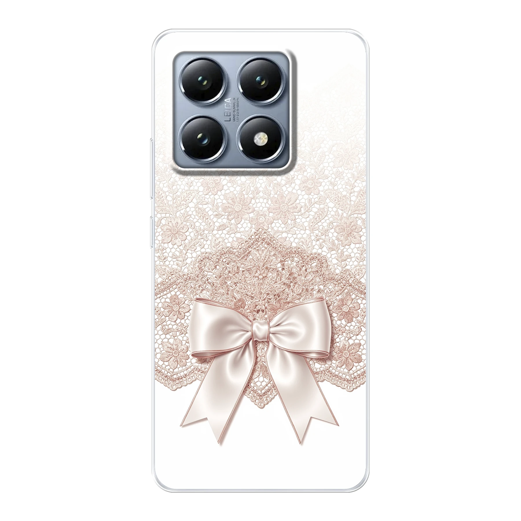 Xiaomi 14T phone case