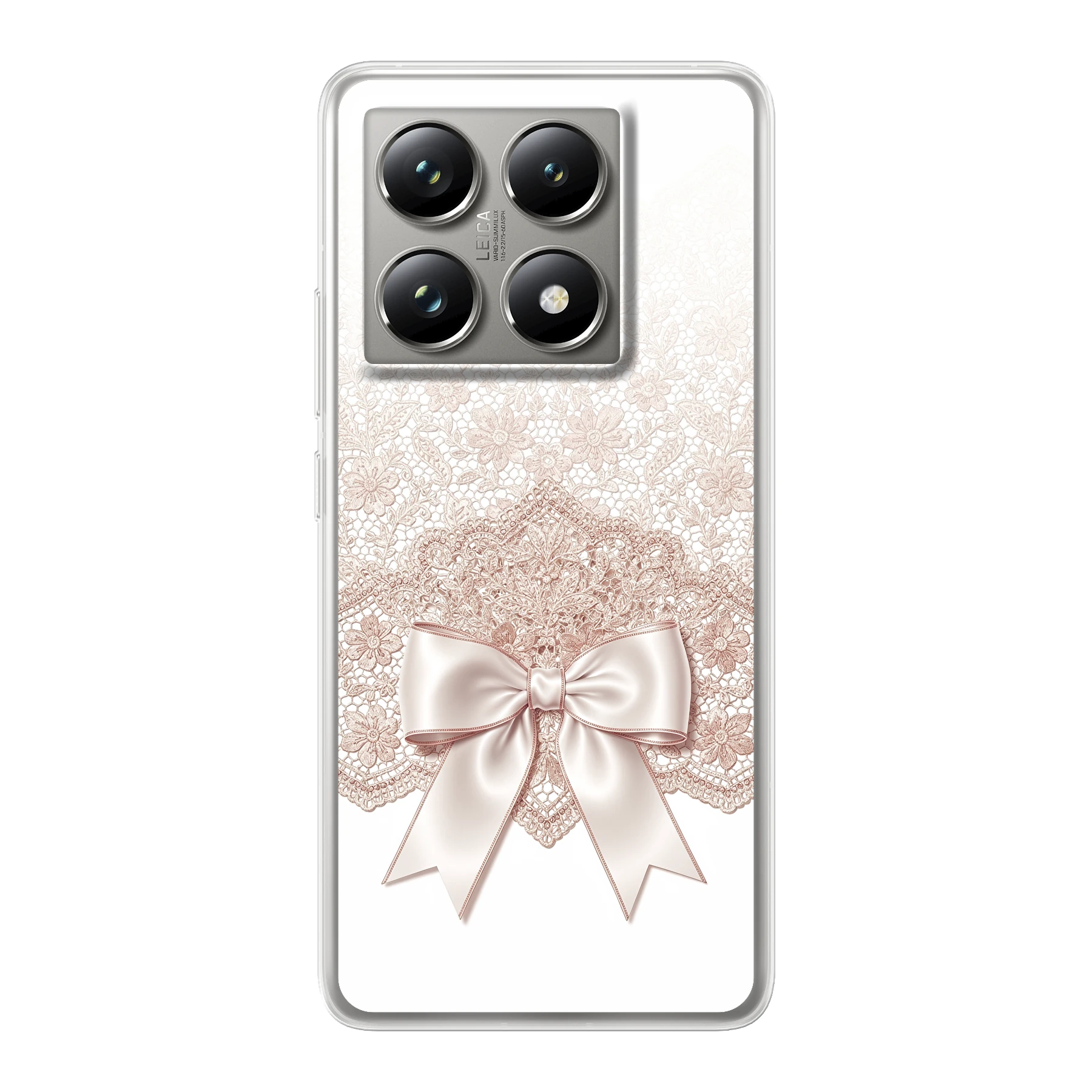 Xiaomi 14T Pro phone case