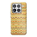 Xiaomi 15 phone case