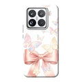 Xiaomi 15 phone case
