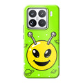 Xiaomi 15 phone case