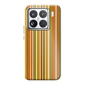 Xiaomi 15 phone case
