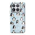 Xiaomi 15 phone case