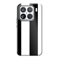 Xiaomi 15 phone case