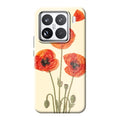Xiaomi 15 phone case