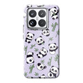 Xiaomi 15 phone case