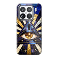 Xiaomi 15 phone case