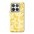 Xiaomi 15 phone case