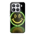 Xiaomi 15 phone case