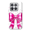 Xiaomi 15 phone case