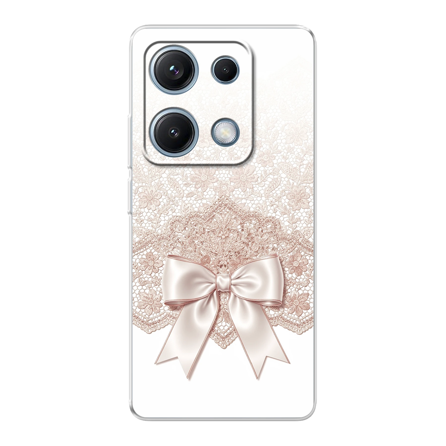Xiaomi Redmi Note 14S phone case